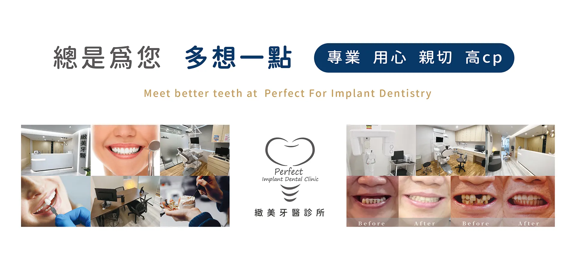 緻美牙醫診所 perfect implant dental clinic 專業 用心 親切 高cp